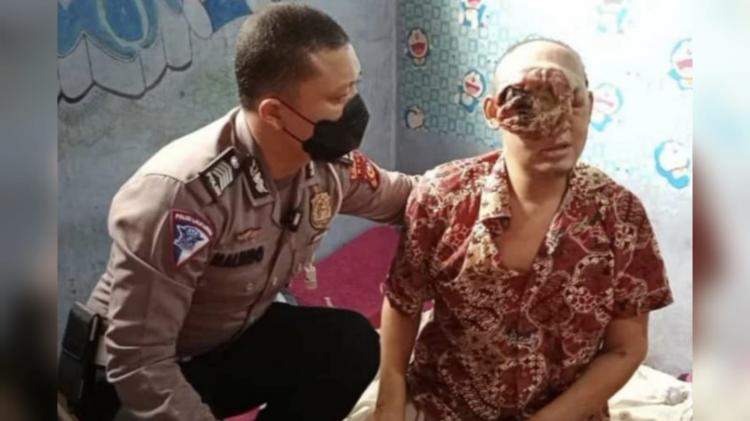 Warga Inhu Mengidap Tumor Ganas, Polisi Bantu Carikan Donasi 